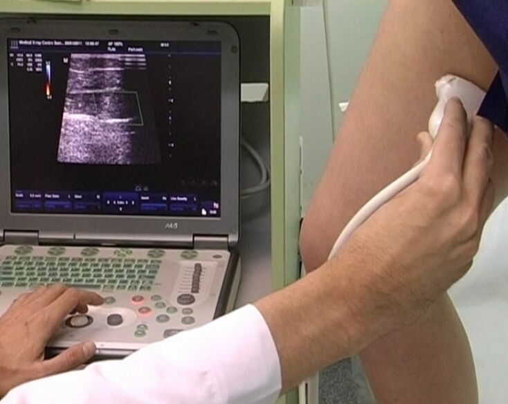 ultrasound diagnosis of pelvic varices