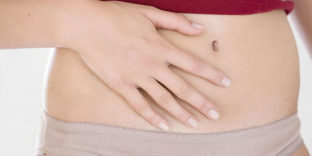 varicose veins of the pelvis in women